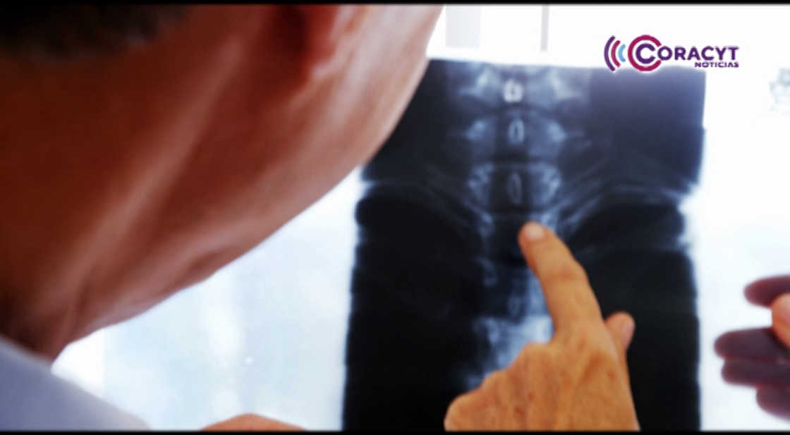 Sector Salud ha realizado 26 mil tamizajes gratuitos de osteoporosis